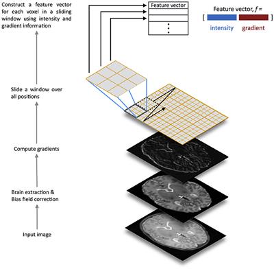 SEGMA: An Automatic SEGMentation Approach for Human Brain MRI Using Sliding Window and Random Forests